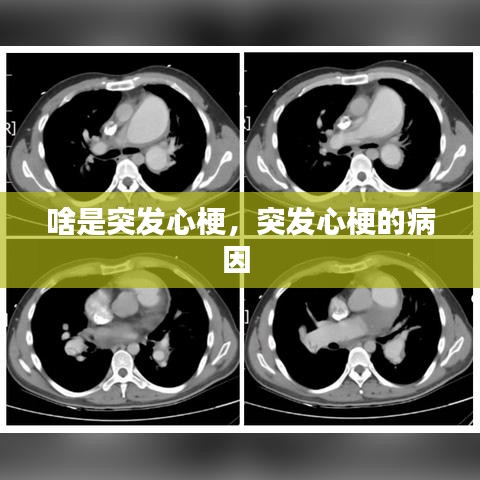 啥是突发心梗，突发心梗的病因 